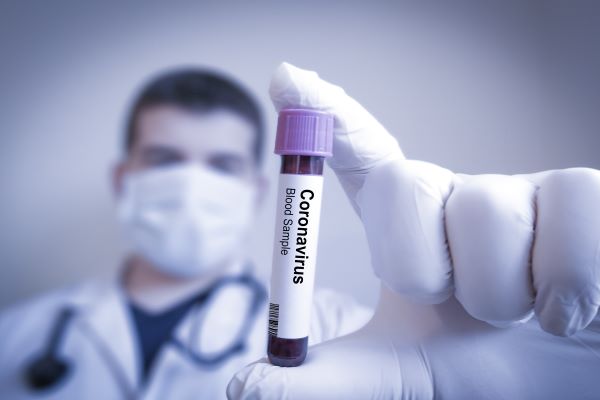 Coronavirus (COVID-19) : reconfinement, couvre-feu… le point au 19 mars 2021