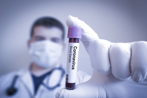 Coronavirus (COVID-19) et difficulté des entreprises : certaines mesures exceptionnelles sont prolongées !